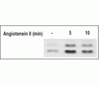Angiotensin II