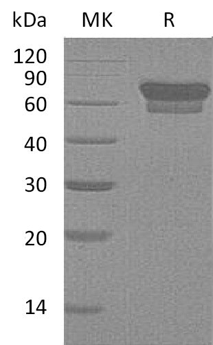 Recombinant Mouse PD-1/PDCD1 Protein (Fc Tag) – Figure 1 of 2