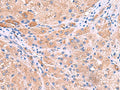 MPP1 Polyclonal Antibody – Figure 1 of 3
