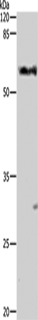 ALDH1A1/2/3 Polyclonal Antibody – Figure 1 of 3