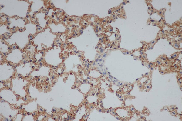 CD244 Polyclonal Antibody – Figure 1 of 2