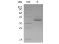 Recombinant Human CXCL10 Protein (Fc & His Tag) – Figure 1 of 2