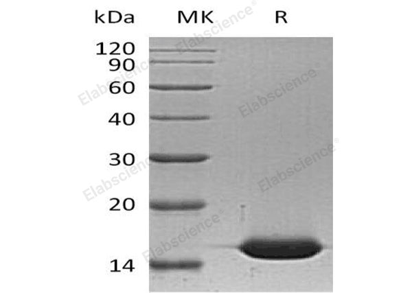Recombinant Human L-FABP/FABP1 Protein (His Tag) – Figure 1 of 2