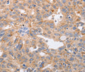 PPP1CB Polyclonal Antibody – Figure 1 of 3