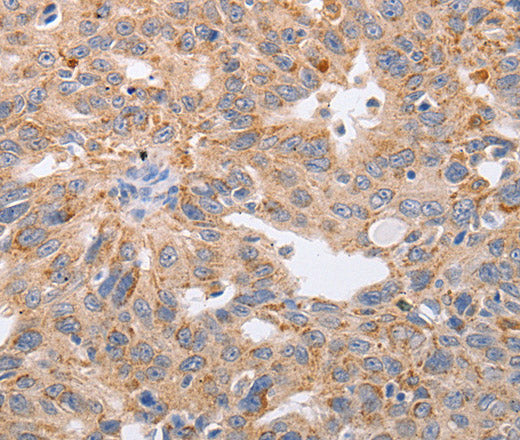 PPP1CB Polyclonal Antibody – Figure 1 of 3