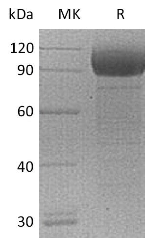 Recombinant Mouse IL1RL1/ST2 Protein (Fc Tag) – Figure 1 of 2
