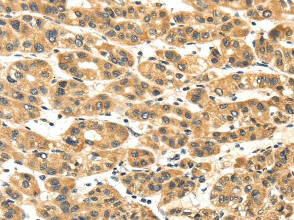 NME8 Polyclonal Antibody – Figure 1 of 2