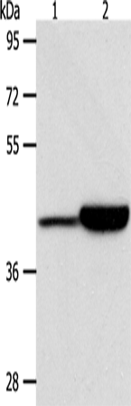CAPG Polyclonal Antibody – Figure 1 of 4