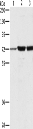 DOK1 Polyclonal Antibody – Figure 1 of 2