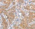 ATG12 Polyclonal Antibody – Figure 1 of 3