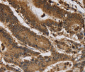 ITPR3 Polyclonal Antibody – Figure 1 of 3