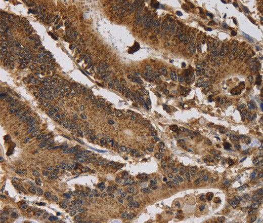 ITPR3 Polyclonal Antibody – Figure 1 of 3