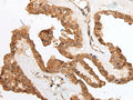 HOXB9 Polyclonal Antibody – Figure 1 of 3