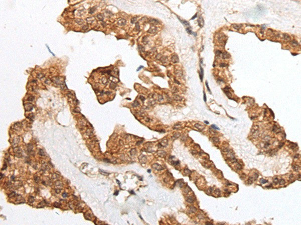 HOXB9 Polyclonal Antibody – Figure 1 of 3