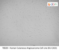 Human Cutaneous Angiosarcoma Cell Line (KU-CAS3) | Applied Biological Materials (abm)