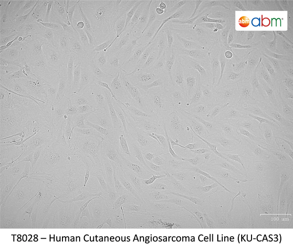 Human Cutaneous Angiosarcoma Cell Line (KU-CAS3) | Applied Biological Materials (abm)