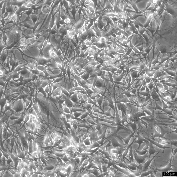 GIMEN cell
