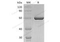 Recombinant Human PCSK9 Protein (D374Y, His Tag) – Figure 1 of 2