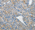 EPHB3 Polyclonal Antibody – Figure 1 of 2