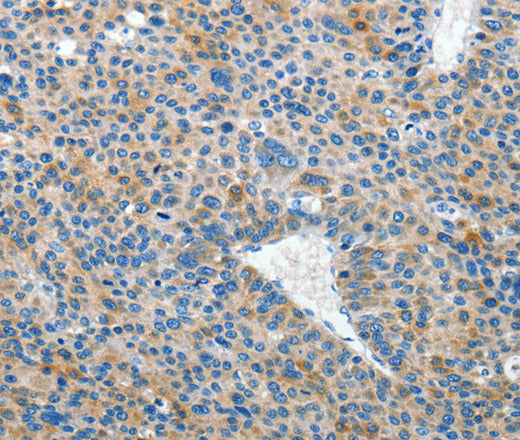 EPHB3 Polyclonal Antibody – Figure 1 of 2