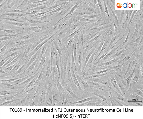 Immortalized NF1 Cutaneous Neurofibroma Cell Line (icNF09.5) - hTERT – Figure 1 of 1