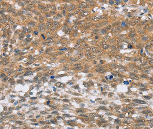 MLH1 Polyclonal Antibody – Figure 1 of 3