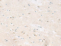 ANKS6 Polyclonal Antibody – Figure 1 of 3