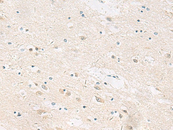 ANKS6 Polyclonal Antibody – Figure 1 of 3