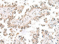 KCTD13 Polyclonal Antibody – Figure 1 of 3