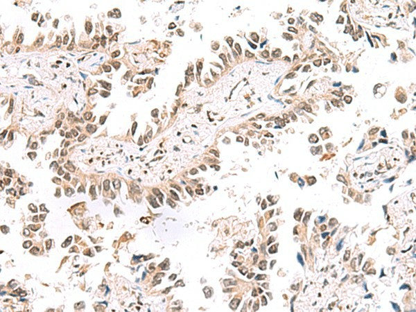 KCTD13 Polyclonal Antibody – Figure 1 of 3