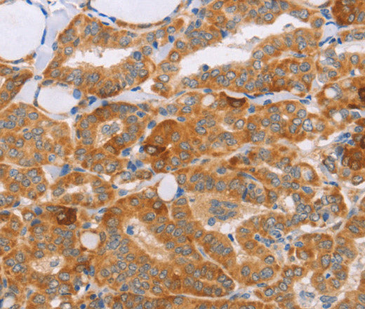 CARD6 Polyclonal Antibody – Figure 1 of 3