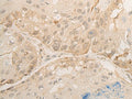 DROSHA Polyclonal Antibody – Figure 1 of 2