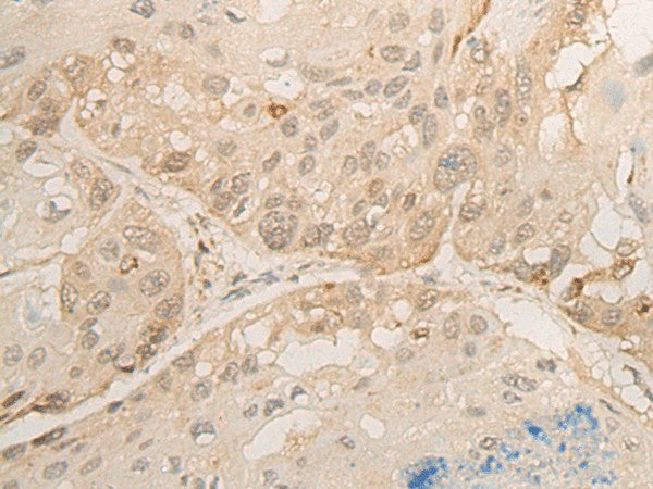DROSHA Polyclonal Antibody – Figure 1 of 2
