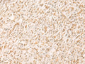 SETD1A Polyclonal Antibody – Figure 1 of 3