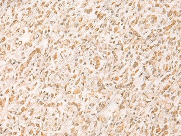 SETD1A Polyclonal Antibody – Figure 1 of 3