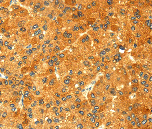 GK1 Polyclonal Antibody – Figure 1 of 3