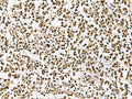 UBLCP1 Polyclonal Antibody – Figure 1 of 3