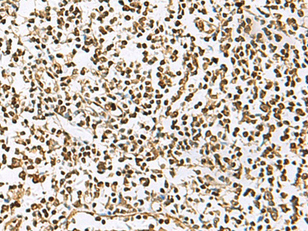 UBLCP1 Polyclonal Antibody – Figure 1 of 3