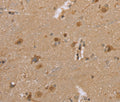 DLD Polyclonal Antibody – Figure 1 of 3