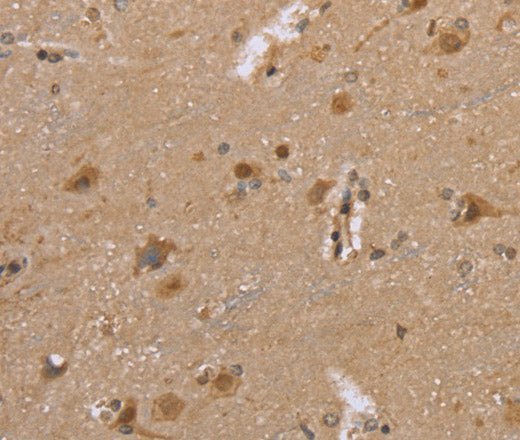 DLD Polyclonal Antibody – Figure 1 of 3