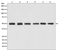 Anti-beta Tubulin Rabbit Monoclonal Antibody, HRP Conjugated