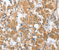 CHMP4B Polyclonal Antibody – Figure 1 of 3