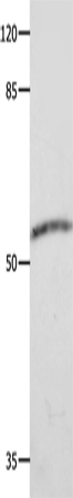 CAP2 Polyclonal Antibody – Figure 1 of 4