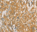 PRPSAP1 Polyclonal Antibody – Figure 1 of 3