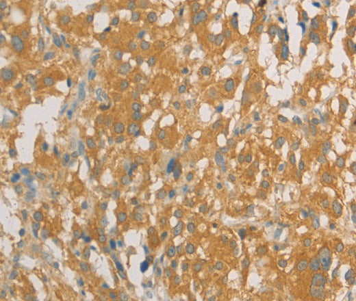 PRPSAP1 Polyclonal Antibody – Figure 1 of 3