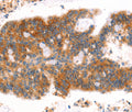 AFDN Polyclonal Antibody – Figure 1 of 3
