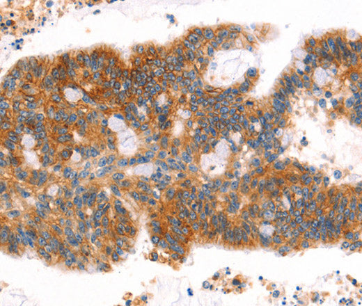 AFDN Polyclonal Antibody – Figure 1 of 3