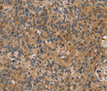 TAC1 Polyclonal Antibody – Figure 1 of 4