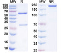 SDS-PAGE for Anti-Human PLXDC2 Antibody (SAA1849)