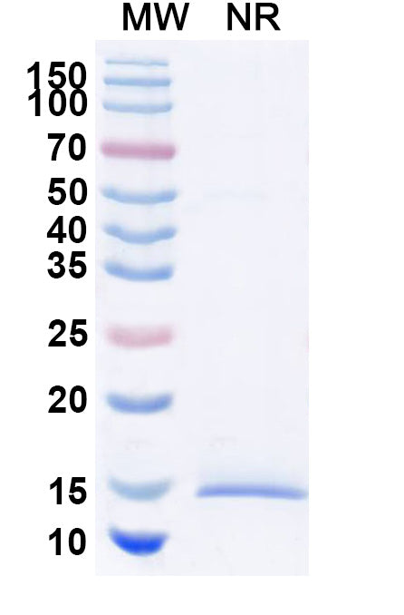 SDS-PAGE for Anti-Human DCBLD2/CLCP1 Antibody (SAA1889)